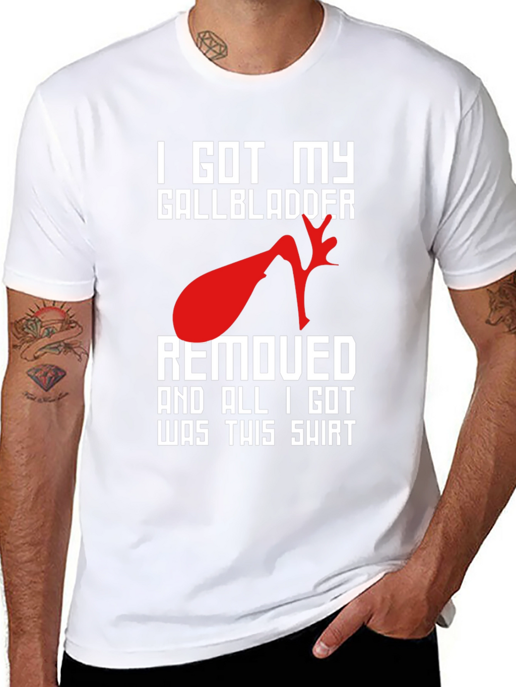 I Got My Gallbladder Removed T-Shirt