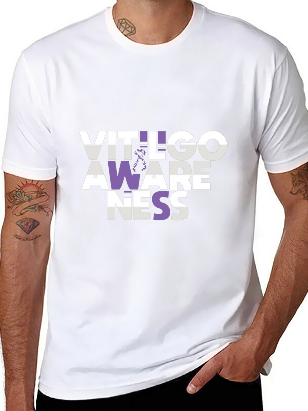Vitiligo Awareness T-Shirt - Show Your Support